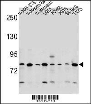 DCBLD2 Antibody (C-term)