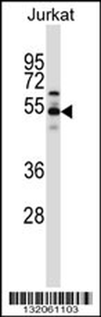 VPS4B Antibody (C-term)