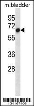 Mouse Acvr1 Antibody (Center)
