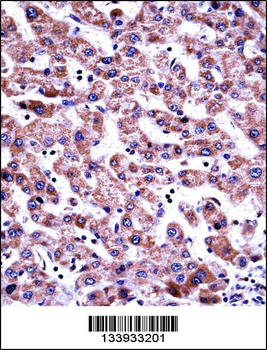 GDI2 Antibody (Center)