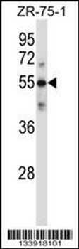 C9 Antibody (Center)