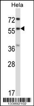 RANGAP1 Antibody (N-term)