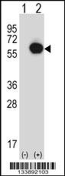 RANGAP1 Antibody (N-term)