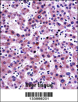 NNMT Antibody (Center)