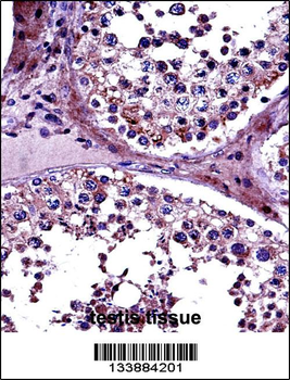 PRMT5 Antibody (N-term)