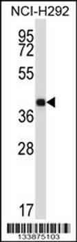SYT2 Antibody (Center)