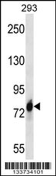 CDH16 Antibody (C-term)