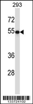 TUBB2A Antibody (C-term)