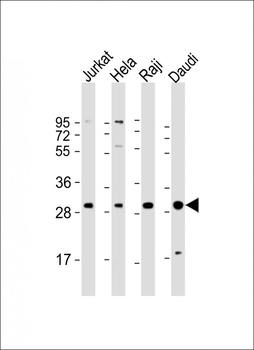 ANP32A Antibody (Center)