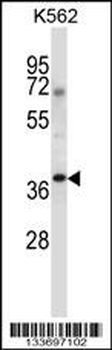 NCK1 Antibody (N-term)