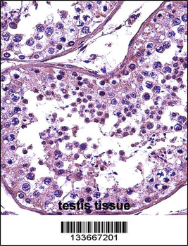 HDAC4 Antibody (C-term)