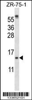 SUMO1 Antibody (N-term)