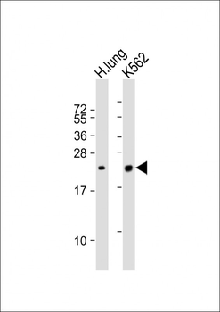 SFTPC Antibody (C-term)