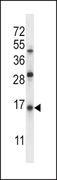 SFTPC Antibody (C-term)