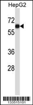 AMIGO1 Antibody (C-term)