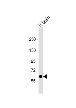 SLC2A13 Antibody (Center)