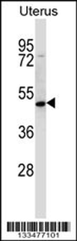 ATOH8 Antibody (N-term)