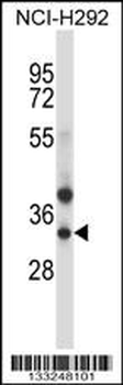 TRIM34 Antibody (N-term)
