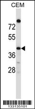 OR4C16 Antibody (C-term)