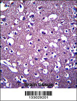 PCDHGA3 Antibody (Center)