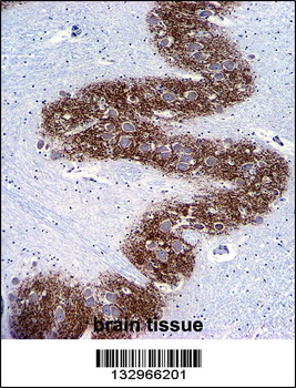 SYP Antibody (C-term)