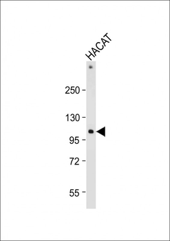 RHBDF2 Antibody (N-term)