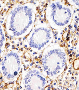 RHBDF2 Antibody (N-term)