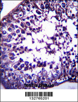 TSPYL5 Antibody (C-term)