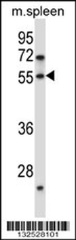 DOK7 Antibody (N-term)