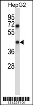 TMEM49 Antibody (C-term)