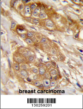 GRINA Antibody (Center)