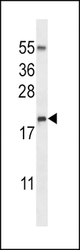 RNASE3 Antibody (C-term)