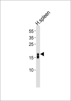 RNASE3 Antibody (C-term)