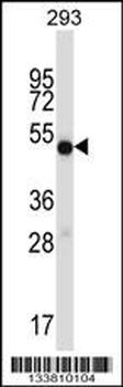 IMPDH1 Antibody (C-term)