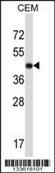 ACTG2 Antibody (C-term)