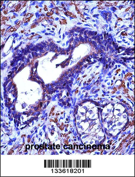 ACTG2 Antibody (C-term)