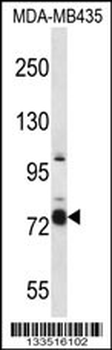 CASS4 Antibody (C-term)