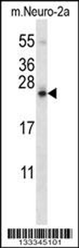 SDF2L1 Antibody (C-term)
