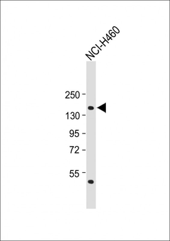 NPC1 Antibody (Center)