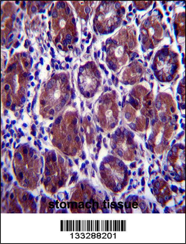EIF2S1 Antibody (N-term)