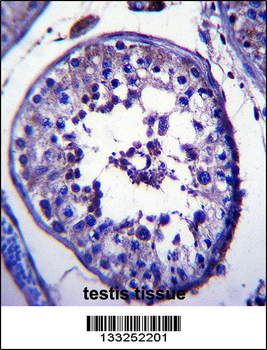 TRIM39 Antibody (Center)