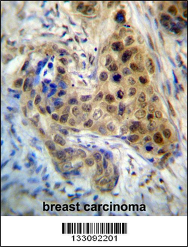 RPL3 Antibody (Center)