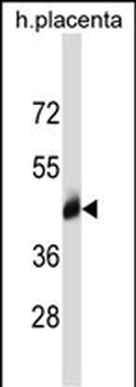 PP11 Antibody (N-term)