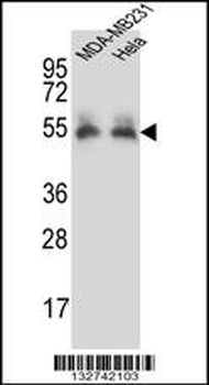 PRCP Antibody (N-term)
