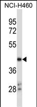 NHLRC1 Antibody (Center)