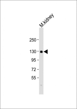 CACNA2D2 Antibody (Center)