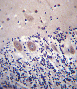 CACNA2D2 Antibody (Center)