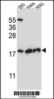 DHFRL1 Antibody (Center)