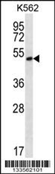 MORN1 Antibody (N-term)