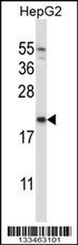 NDUFAF2 Antibody (Center)